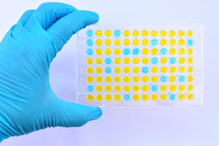 Elisa Bulk for Liver Disease