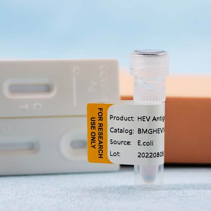 Hepatitis E Virus (HEV) - Image 4