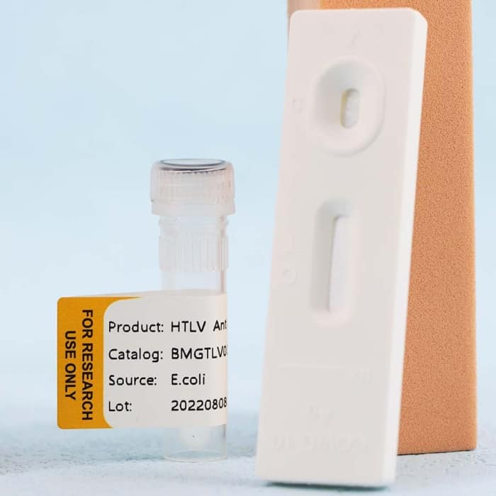 Human T-Cell Lymphotropic Virus (HTLV) - Image 4