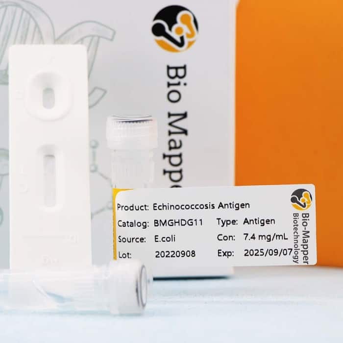 Echinococcosis - Image 2
