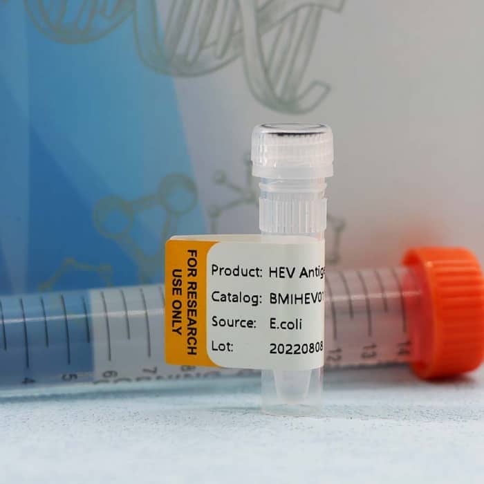 Hepatitis E Virus (HEV) - Image 4