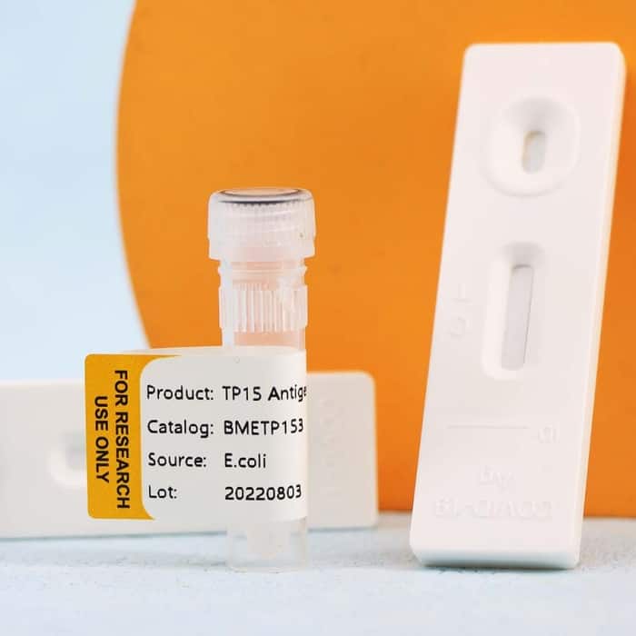 Treponema Pallidum (SYPHILIS) - Image 4