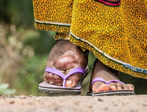 Recommendations for rapid diagnosis of filariasis