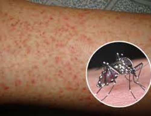 Dengue fever virus increases, learn more